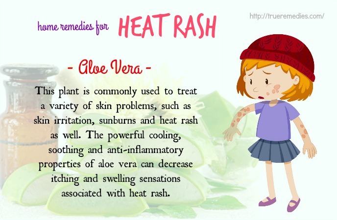 home remedies for heat rash 