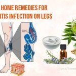 home remedies for cellulitis