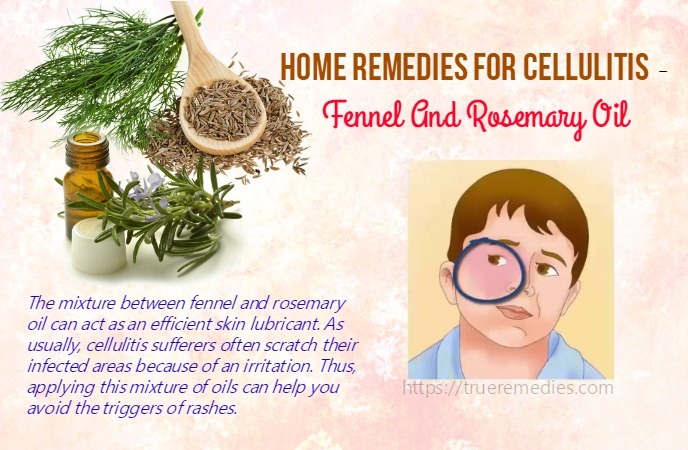 home remedies for cellulitis - fennel and rosemary oil