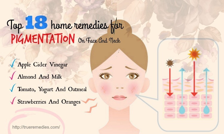 home remedies for pigmentation
