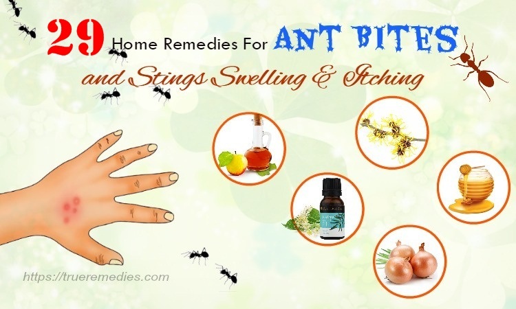 home remedies for ant bites