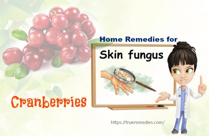 home remedies for skin fungus