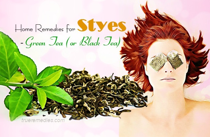 home remedies for styes
