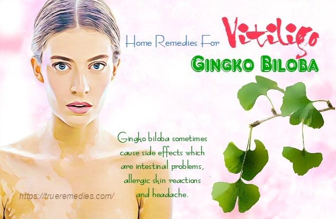 home remedies for vitiligo 