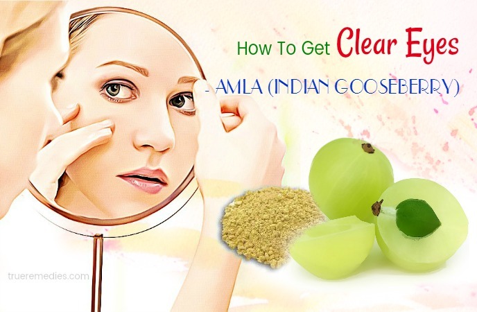 28 Natural Tips How To Get Clear Eyes Fast Without Eye Drops