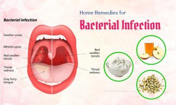 home remedies for bacterial infection