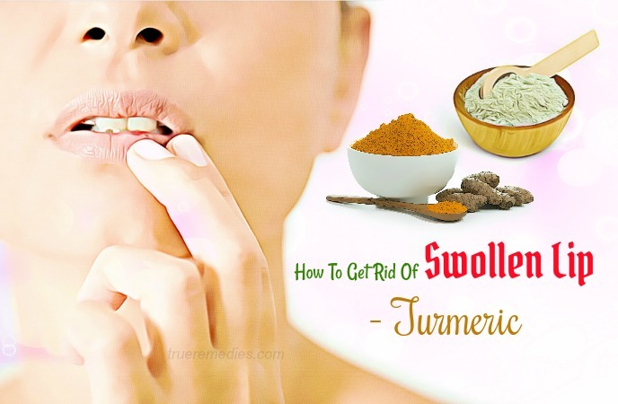 how to get rid of swollen lip 