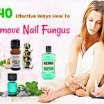 how to remove nail fungus