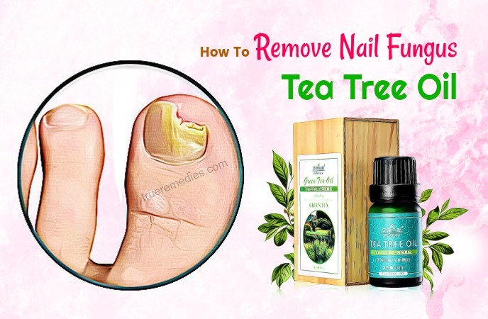 how to remove nail fungus