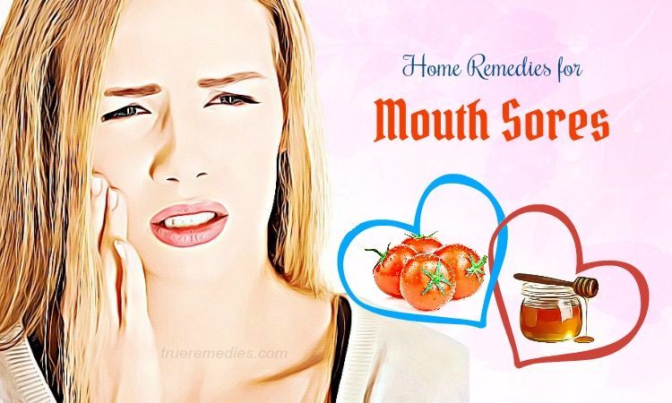 home remedies for mouth sores
