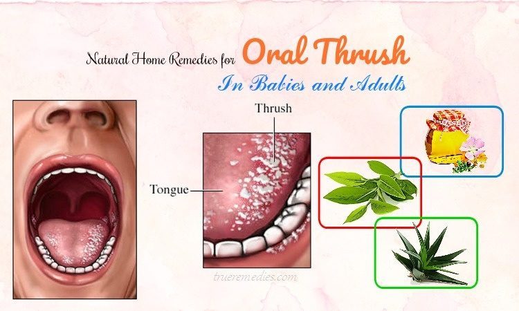 home remedies for oral thrush