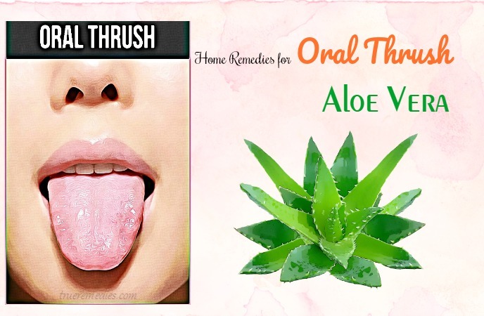 home remedies for oral thrush - aloe vera
