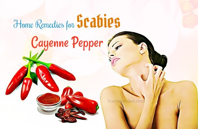 home remedies for scabies 