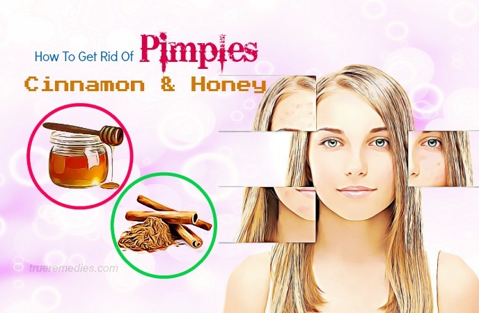 how to get rid of pimples 