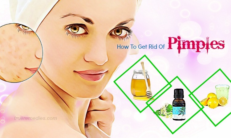 how to get rid of pimples
