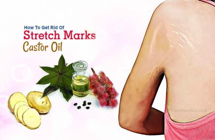 how to get rid of stretch marks