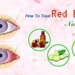 how to treat red eyes