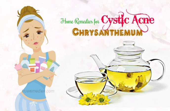 home remedies for cystic acne 