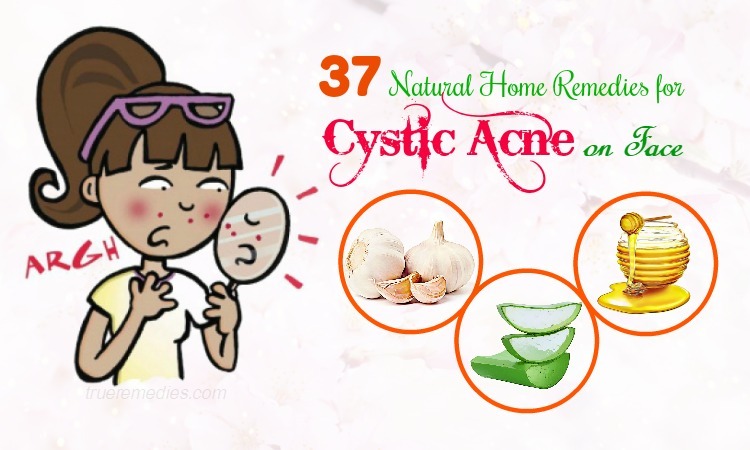 home remedies for cystic acne