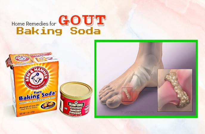 home remedies for gout 