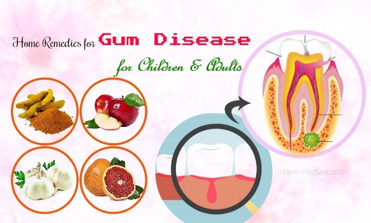 home remedies for gum disease