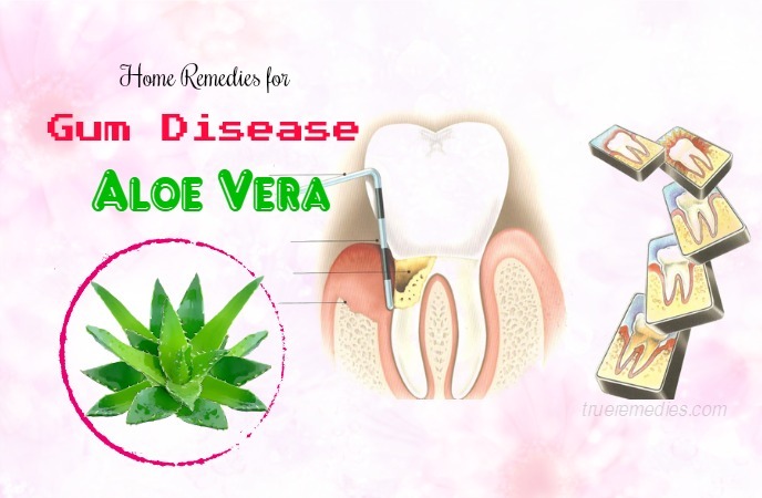 home remedies for gum disease - aloe vera