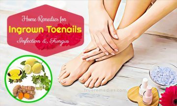 home remedies for ingrown toenails