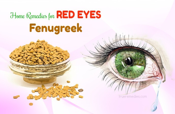 home remedies for red eyes 