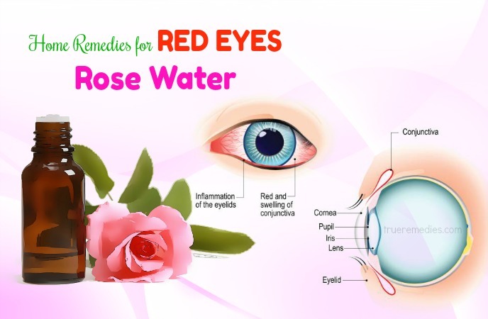 home remedies for red eyes 