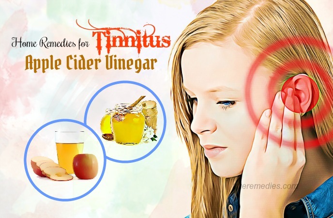 home remedies for tinnitus 