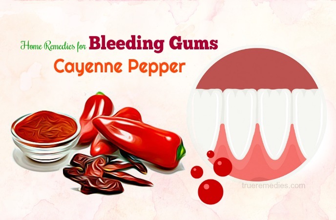 home remedies for bleeding gums 