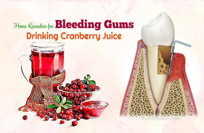 home remedies for bleeding gums - drinking cranberry juice