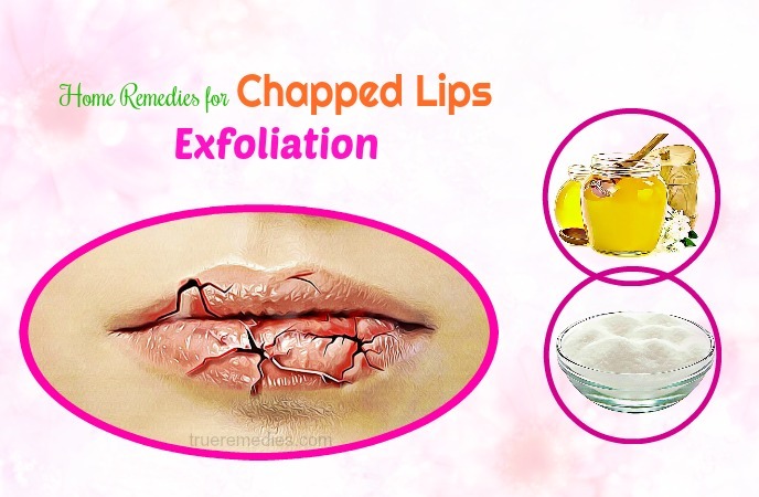 home remedies for chapped lips 