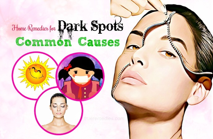 home remedies for dark spots 