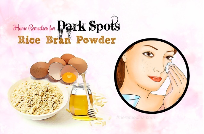 home remedies for dark spots 