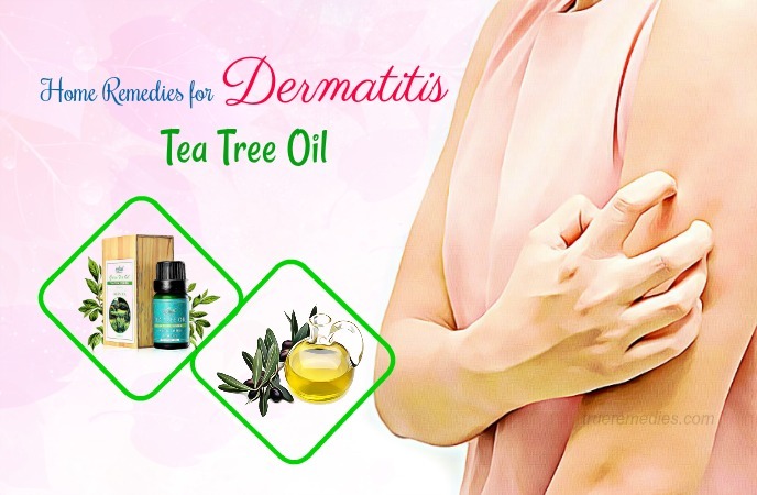 home remedies for dermatitis 