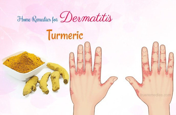 home remedies for dermatitis - turmeric