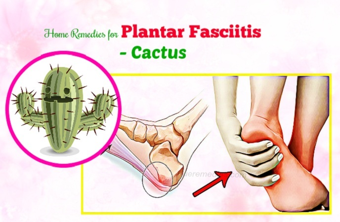 home remedies for plantar fasciitis - cactus