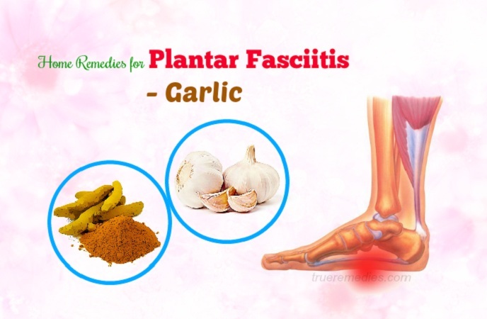 home remedies for plantar fasciitis 