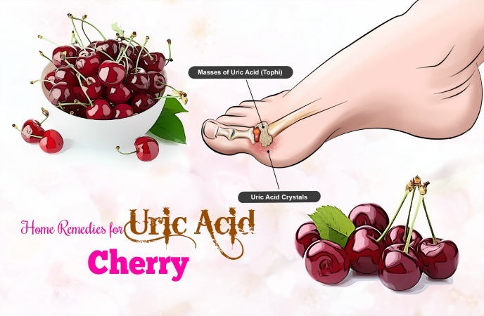 home remedies for uric acid 