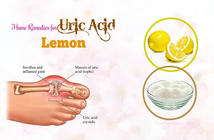 home remedies for uric acid 