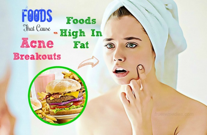 foods that cause acne breakouts