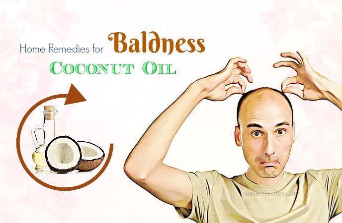 home remedies for baldness