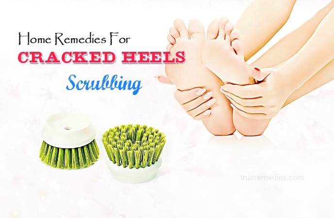 home remedies for cracked heels 