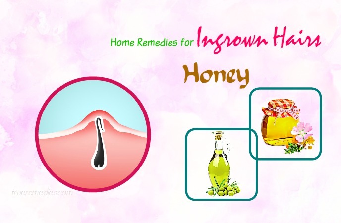 home remedies for ingrown hairs 