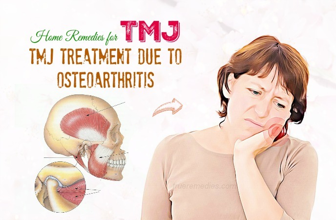 home remedies for tmj 