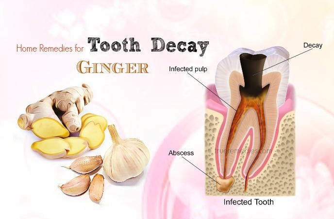 home remedies for tooth decay 