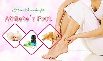 home remedies for athletes foot