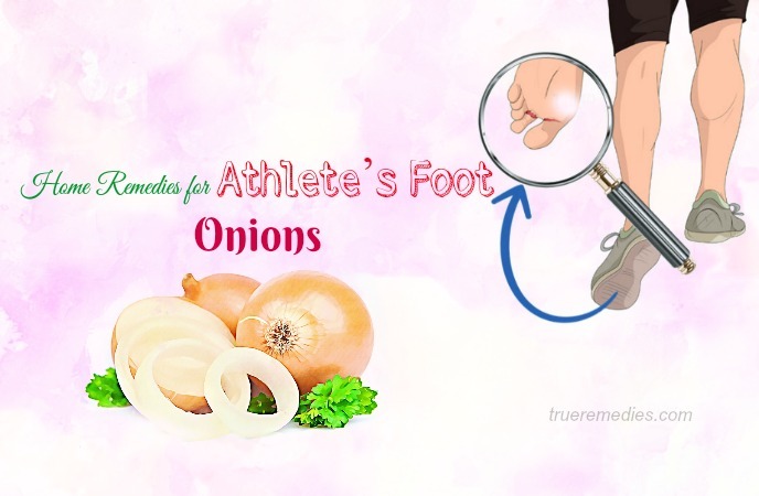 home remedies for athletes foot 