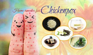 home remedies for chickenpox